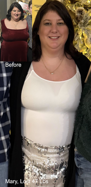 Before and after image of Mary who lost 47 lbs in 2 months with ESG