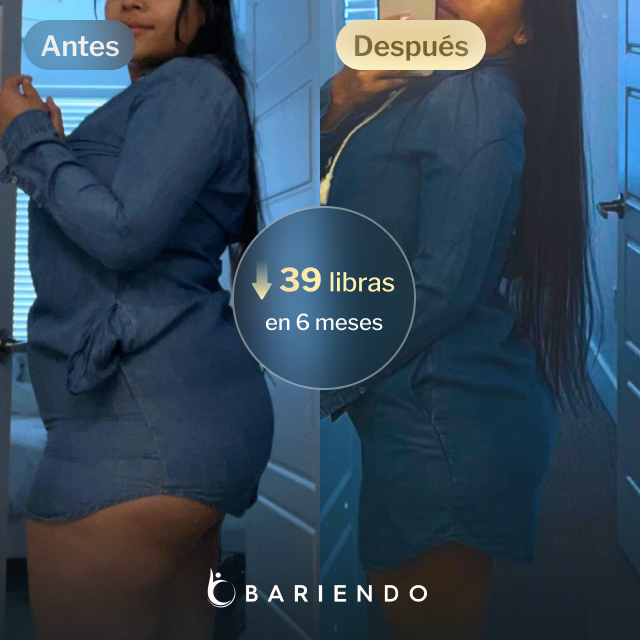 Imágenes de antes y después de Daniela, quien perdió 39 libras en 6 meses tras un balón gástrico con Everself.