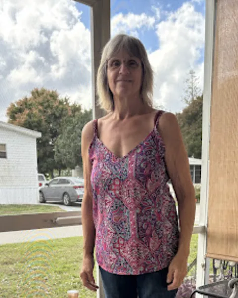 Debra after ESG Stomach Tightening