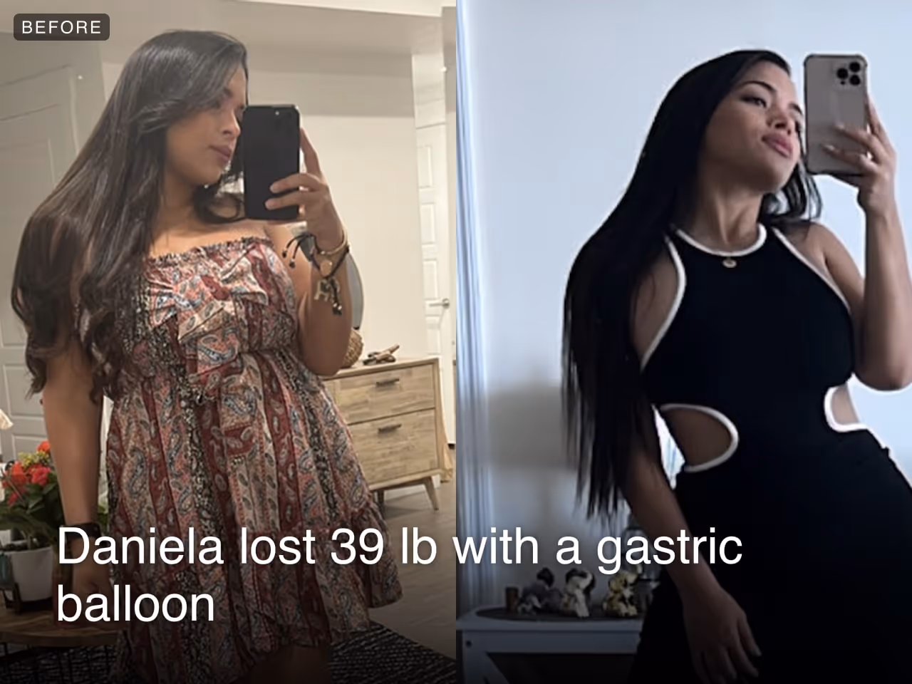 Before and after images of Daniela who lost 39 pounds in 6 months after a Gastric Balloon procedure with Everself