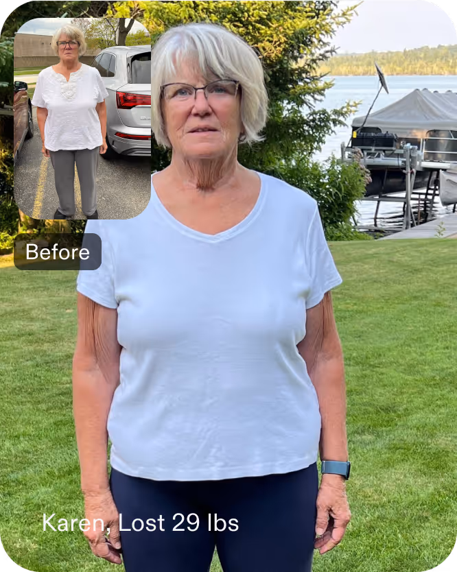 Karen lost 29 pounds after an ESG with Everself