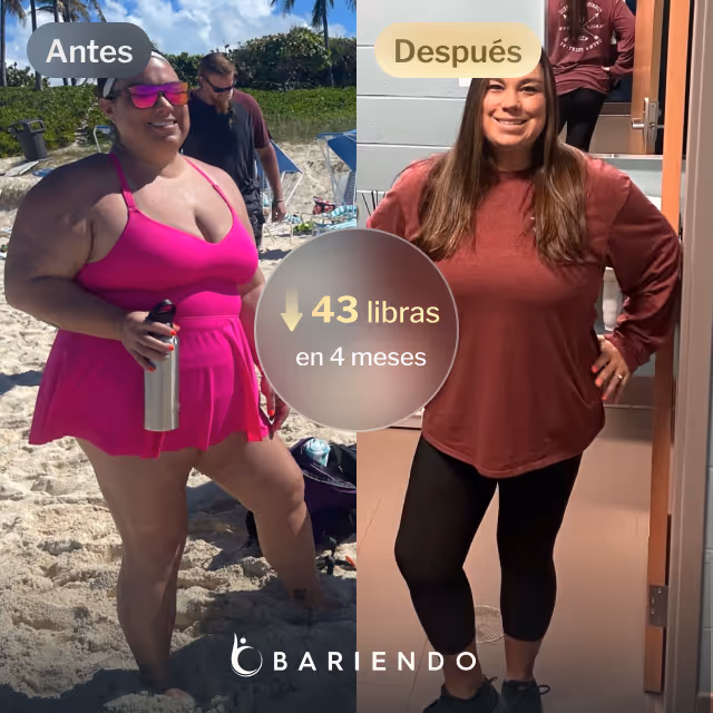 Imágenes de antes y después de Mindi, la paciente ESG de Everself que perdió 43 libras en 4 meses
