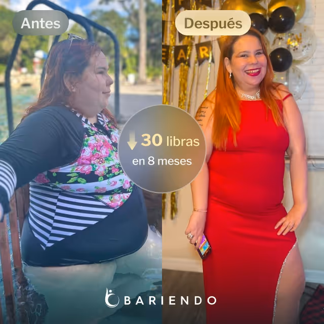 Imágenes de antes y después de Isola, quien perdió 30 libras en 8 meses tras un procedimiento de Balón Gástrico con Everself