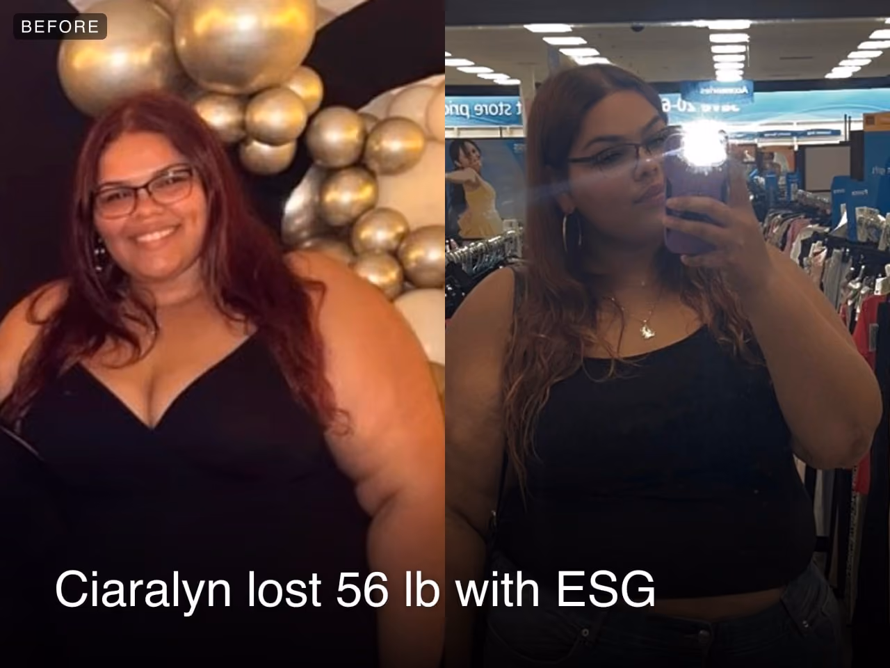 Ciaralyn lost 56 pounds in 3 months with an ESG from Everself