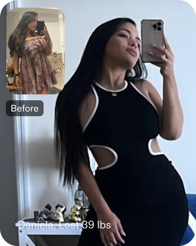 Before and after images of Daniela who lost 39 pounds in 6 months after a Gastric Balloon procedure with Everself