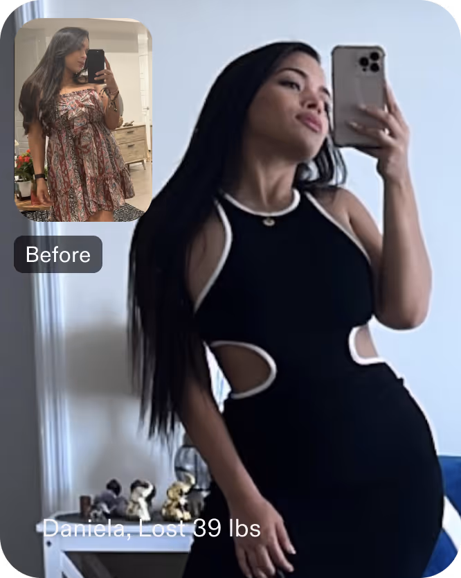Before and after images of Daniela who lost 39 pounds in 6 months after a Gastric Balloon procedure with Everself