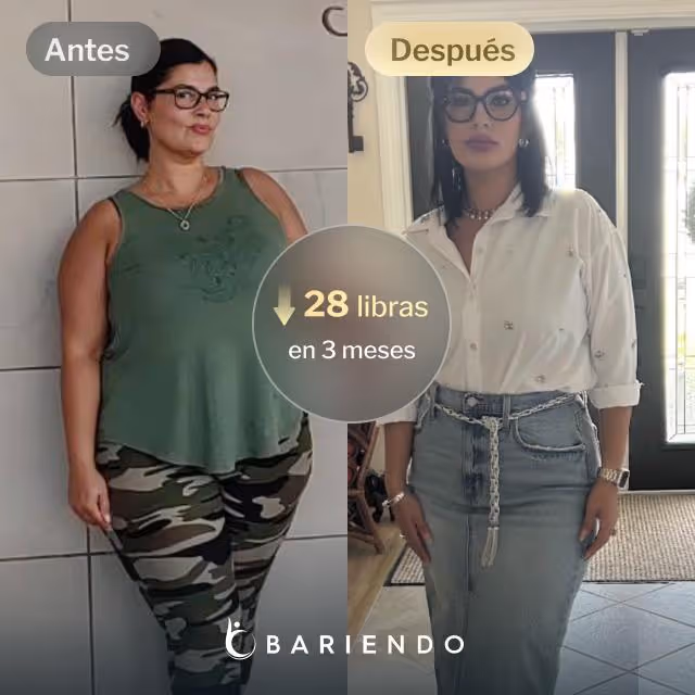 Imágenes de antes y después de Candy, quien perdió 28 libras en 3 meses a través del procedimiento de Reducción de Estómago ESG de Everself.