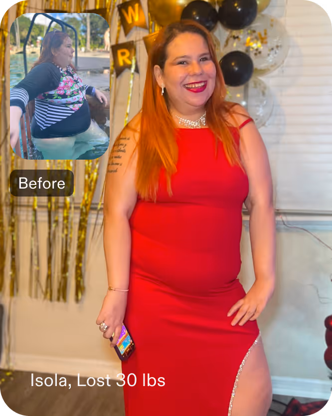 Before and after images of Isola who lost 30 pounds in 8 months after a Gastric Balloon procedure with Everself