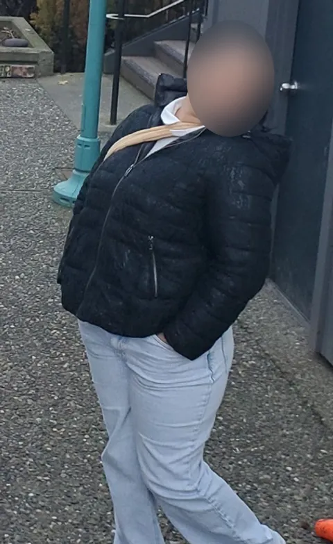 Margarett  before a gastric balloon
