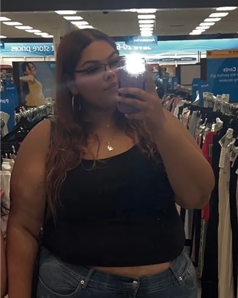 Ciaralyn after ESG Stomach Tightening