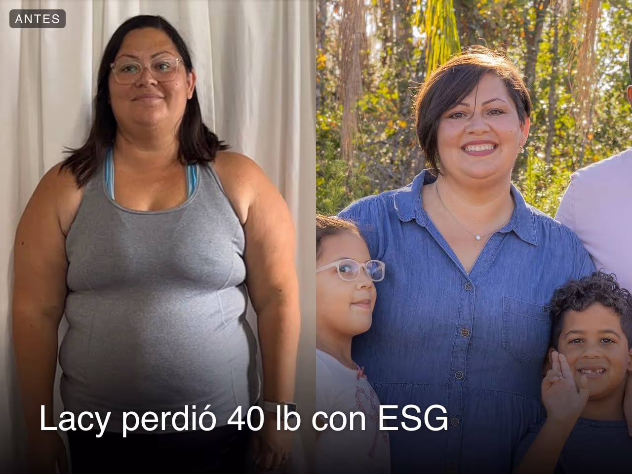 Lacy perdió 40 libras con ESG de Everself