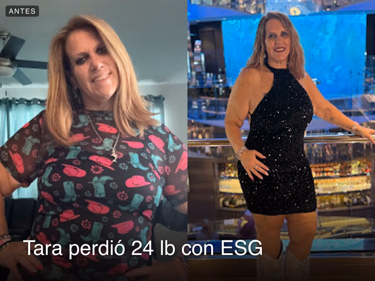 Imagen de antes y después de Tara, quien perdió 24 libras en 6 meses con ESG