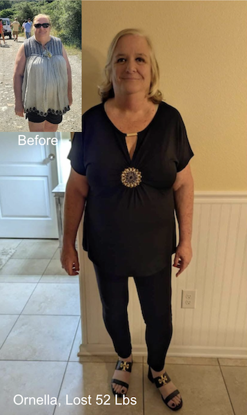 Before and after image of Ornella who lost 52 lbs in 5 months with ESG