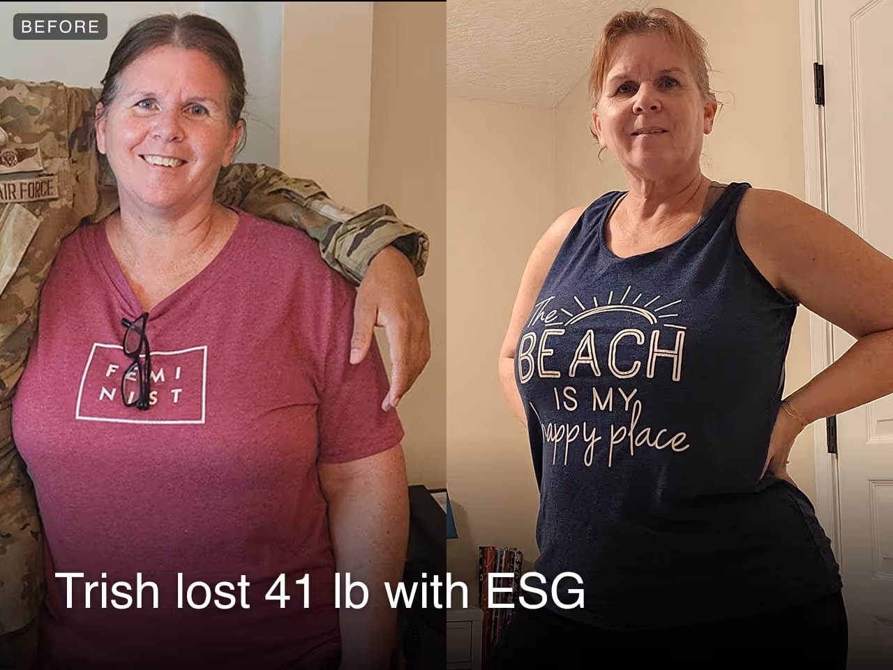 Trish lost 41 pounds with Everself