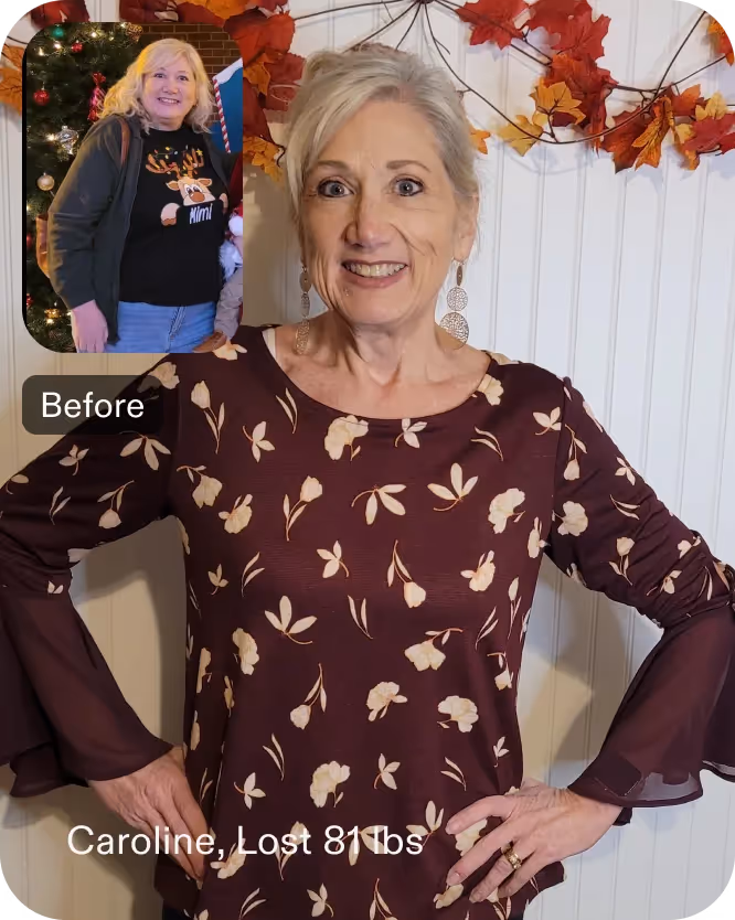 Caroline lost 51 pounds with an ESG from Everself