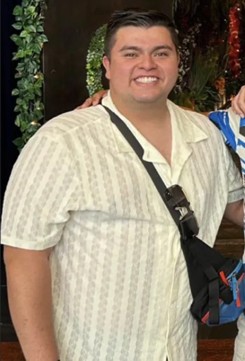 Javier before ESG Stomach Tightening