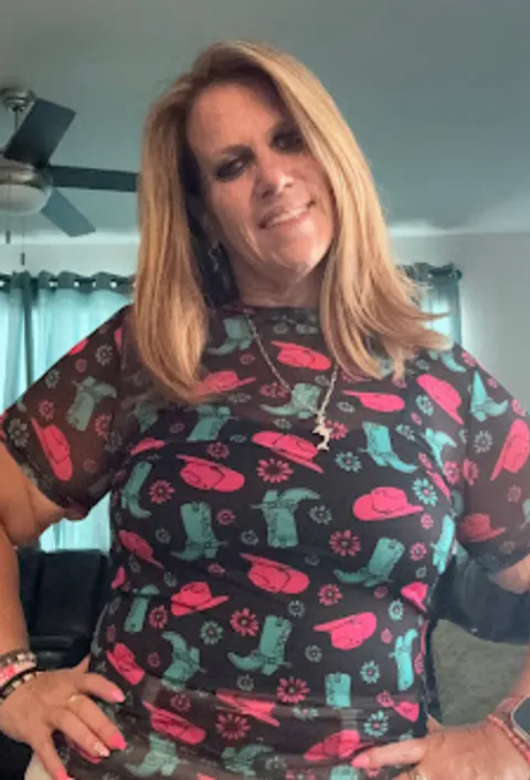 Tara before ESG Stomach Tightening