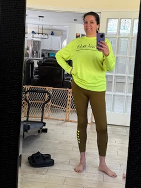 Susana after ESG Stomach Tightening