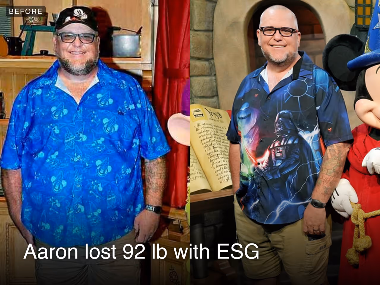 Before and after image of Aaron who lost 92 lbs in 4 months with ESG
