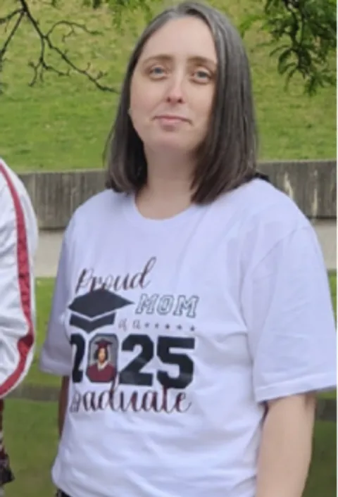 Helen after ESG Stomach Tightening