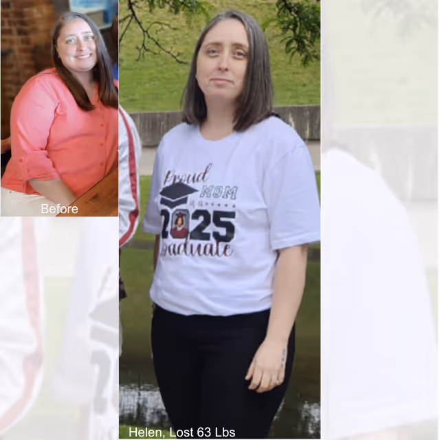 Helen got a fresh start and lost 63 pounds with Everself's ESG procedure