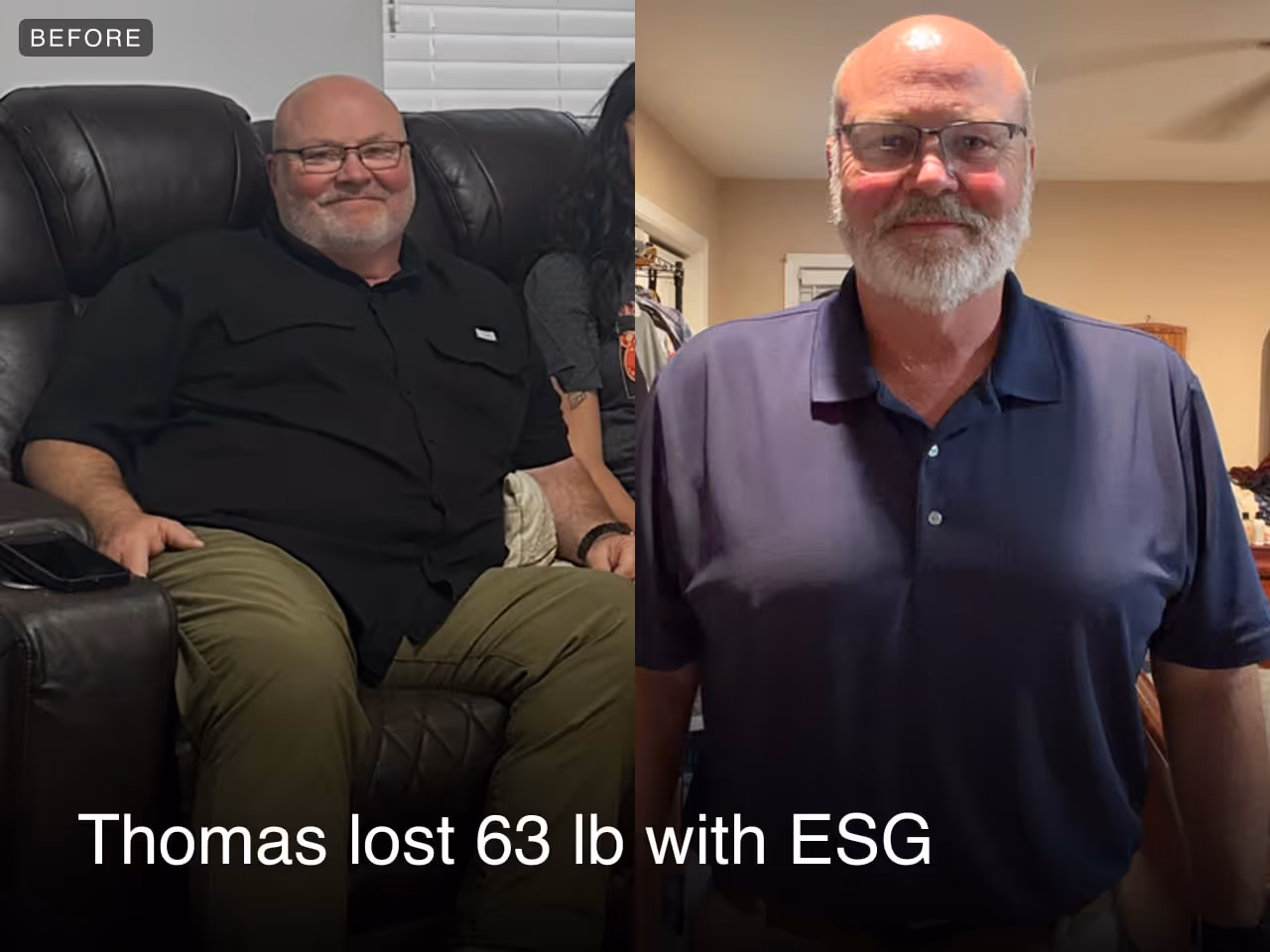 Before and after image of Thomas who lost 63 lbs in 4 months with ESG