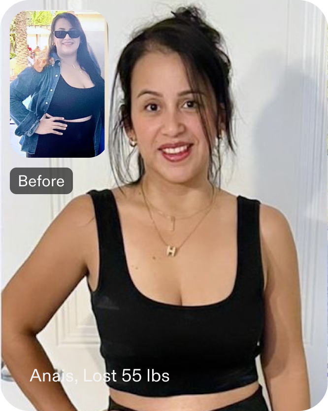 Before and after images of Anais who lost 55 pounds in 6 months after a Gastric Balloon procedure with Everself