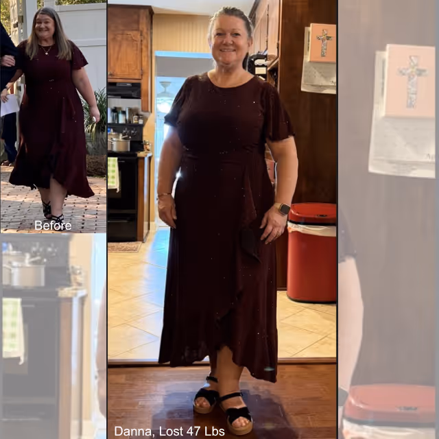 Before and after image of Danna who lost 47 lbs in 4 months with ESG