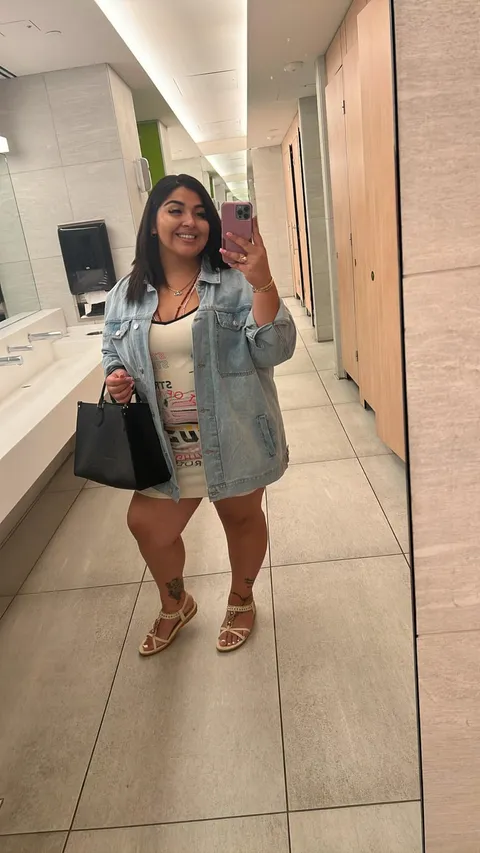 Miriam before ESG Stomach Tightening