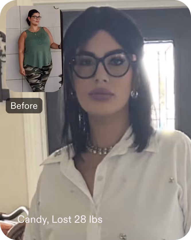 Before and after images of Candy who lost 28 pounds in 3 month through Everself's ESG Stomach Tightening® procedure