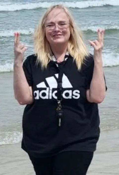 Jackie before TORe gastric bypass revision