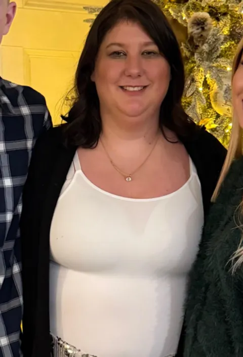 Mary after ESG Stomach Tightening