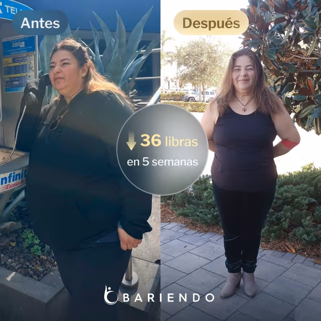 Imágenes de antes y después de Doris, quien perdió 36 libras en 5 semanas tras un procedimiento ESG con Everself.
